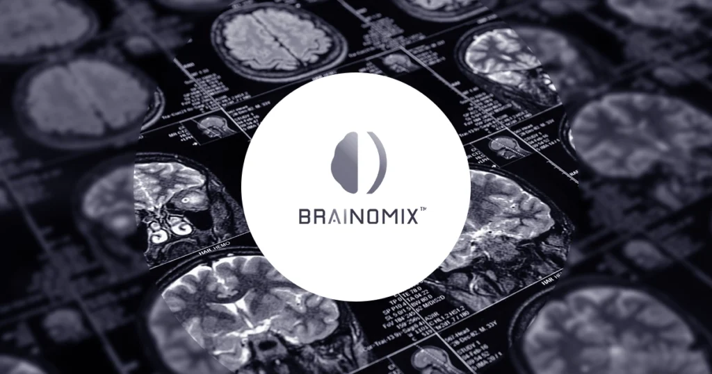 Brainomix case study